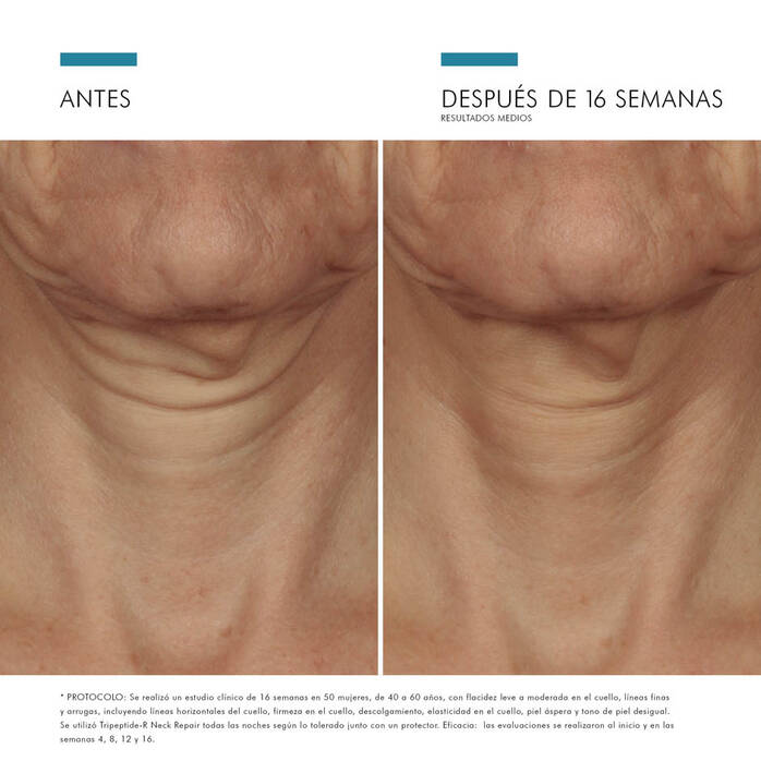 TRIPEPTIDE-R NECK REPAIR