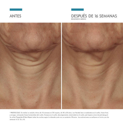 TRIPEPTIDE-R NECK REPAIR