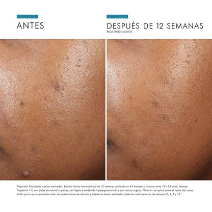 PHYTO A+ BRIGHTENING TREATMENT